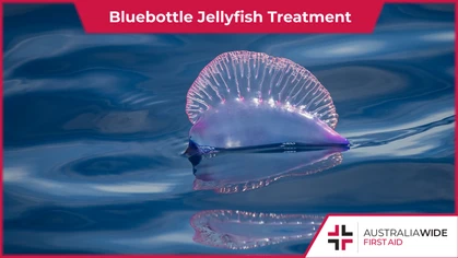 Popular along the Australian east coast during summer, the Bluebottle jellyfish has stinging cells that contain toxic proteins and can cause intense pain, swelling, and even allergic reactions. 