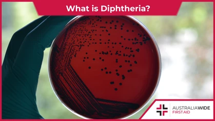 Diphtheria is a bacterial infection that causes a thick membrane to develop in an infected person's throat and tonsils. It is important to know the causes, symptoms, and transmission of diphtheria, as it can be fatal if left untreated. 