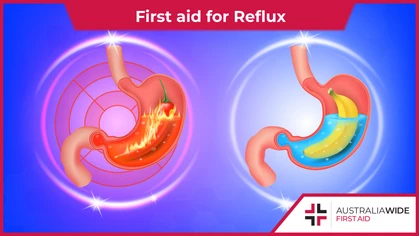 Acid reflux is a condition in which stomach acid rises into the oesophagus. It occurs when the oesophageal sphincter does not tighten properly, such as when we eat too much food. Though acid reflux is usually not a cause for concern, it can lead to oesophageal scarring if left untreated. 
