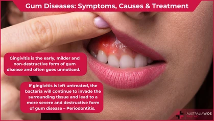 Gum Disease article header