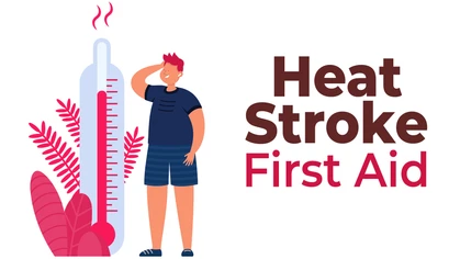 First aid treatment for heat stroke is critical. It is life-threatening and requires immediate action.