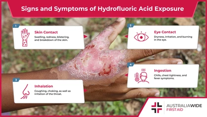 Hydrofluoric acid is a chemical used in many Australian workplaces. When it comes to hydrofluoric acid, severe injuries can be caused by skin contact, eye contact, ingestion, or inhalation. These include burns and blistering on the skin. 