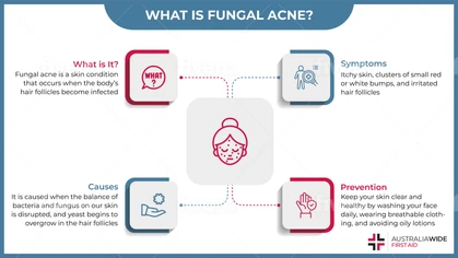 Fungal acne is a skin condition that causes an infection in the body's hair follicles. Fungal acne is often confused with facial acne. However, it's important to know the difference, so you can implement the correct prevention and treatment measures. 