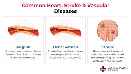 Heart, stroke, and vascular diseases (or cardiovascular disease) is an umbrella term for a wide variety of diseases that affect the heart and blood vessels. Statistics show that cardiovascular disease accounts for a significant number of hospitalisations and deaths in Australia. 