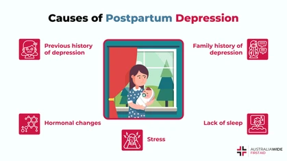 Postpartum depression (PPD) is a form of clinical depression that can occur in women after they give birth.