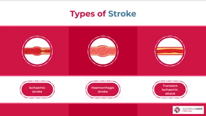 A stroke occurs when the blood flow to a part of the brain is disrupted, either by a blood vessel clot or a blood vessel rupture. It is important to know the different types of stroke, so that you can proactively manage the symptoms and safeguard your health. 
