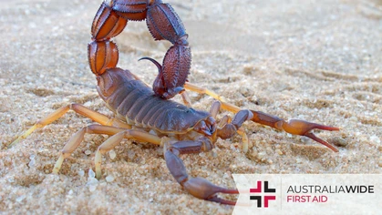 Though we are renowned for our wide variety of venomous snakes and spiders, Australia is also home to more than 100 species of scorpions. And while they typically live in remote habitats, they have been known to enter homes and inflict painful stings. 