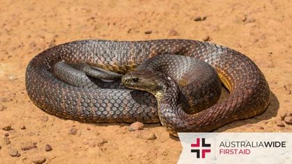 Despite its cooler climate, Melbourne is teeming with a variety of snake species, some of which are among the deadliest in the world. In this article, we will familiarise you with 4 of Melbourne's most common snake species and how to treat their bites. 